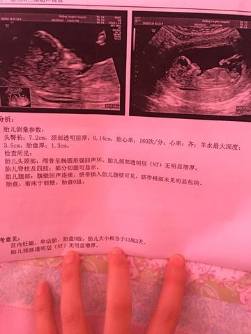 journal_insert_pic_1180295351