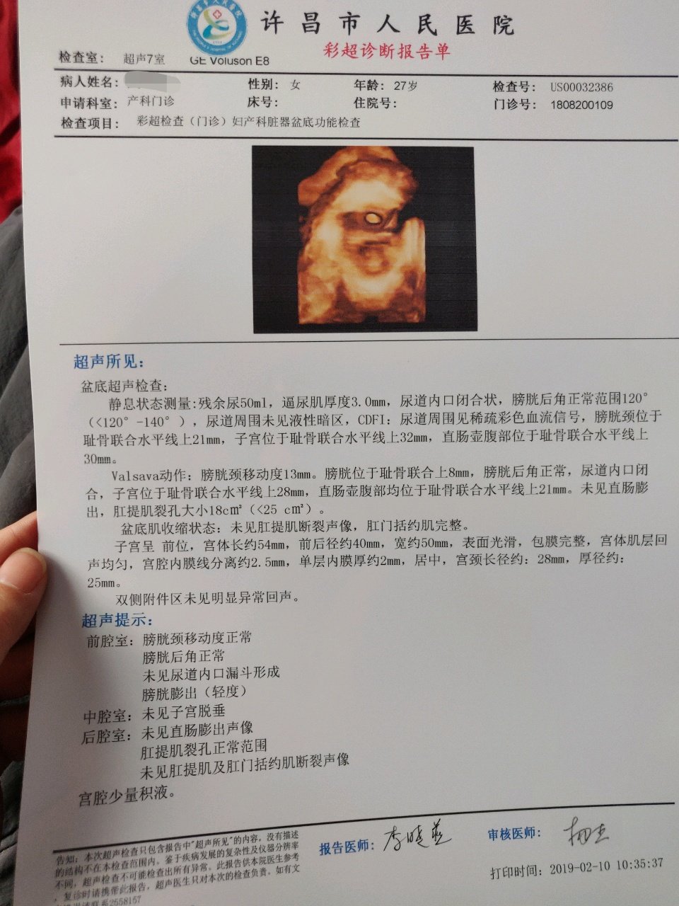 有会看产后盆底复查彩超单的宝妈吗？帮忙看一下
