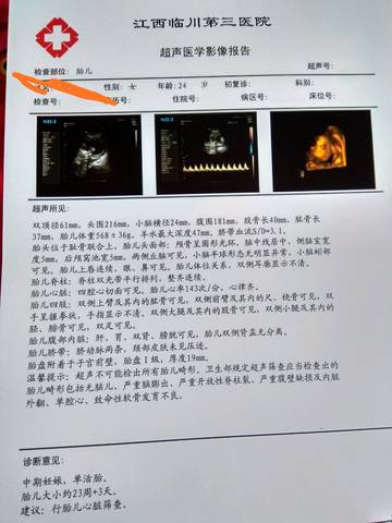 journal_insert_pic_1182609303