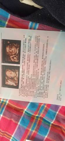 journal_insert_pic_1183830577