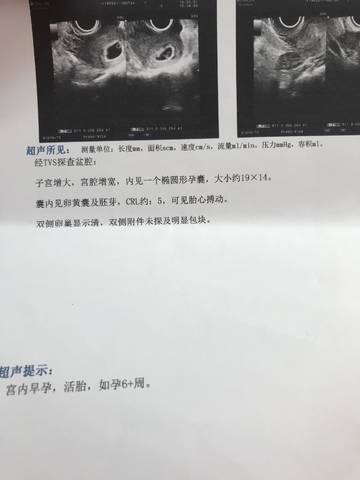 journal_insert_pic_1186238002