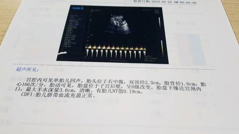journal_insert_pic_1186818429