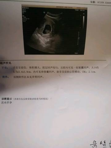 journal_insert_pic_1188840850