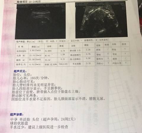 journal_insert_pic_1189376151