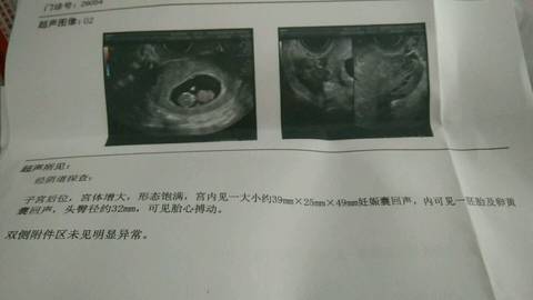 journal_insert_pic_1189810541