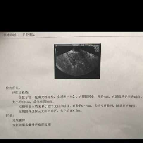 journal_insert_pic_1196453306