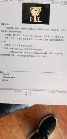 journal_insert_pic_1200311422