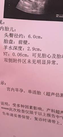 journal_insert_pic_1201679962
