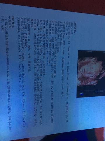 journal_insert_pic_1202455978