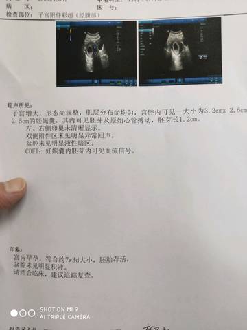 journal_insert_pic_1203852860