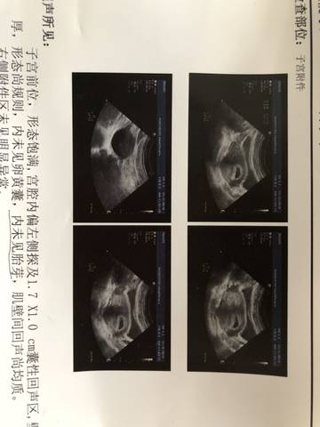 journal_insert_pic_1203887145