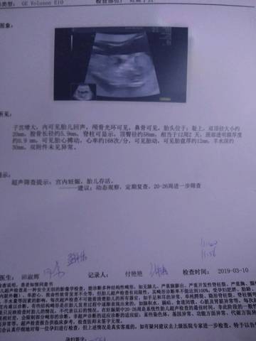 journal_insert_pic_1204031764
