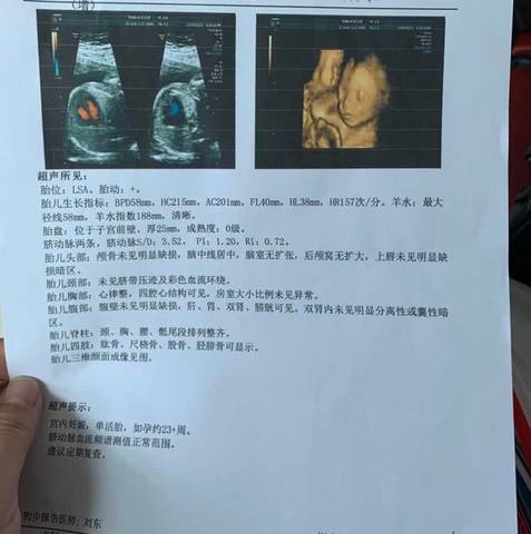 journal_insert_pic_1204237765