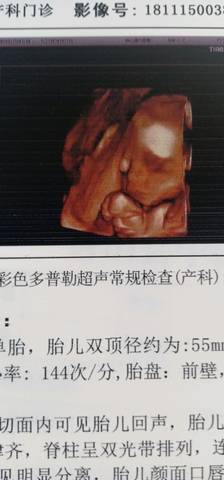 journal_insert_pic_1204565944