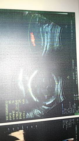 journal_insert_pic_1206878433
