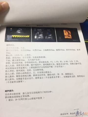 journal_insert_pic_1206665084