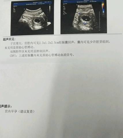 journal_insert_pic_1209629971