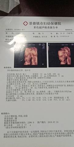 journal_insert_pic_1210133578
