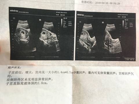 journal_insert_pic_1210492940