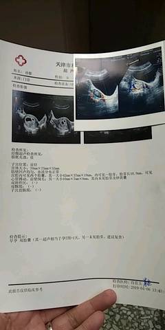 journal_insert_pic_1211230868
