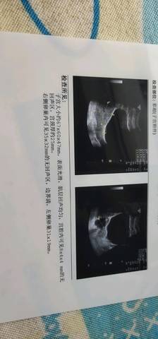 journal_insert_pic_1212646124