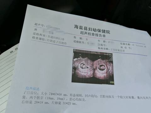journal_insert_pic_1212382101