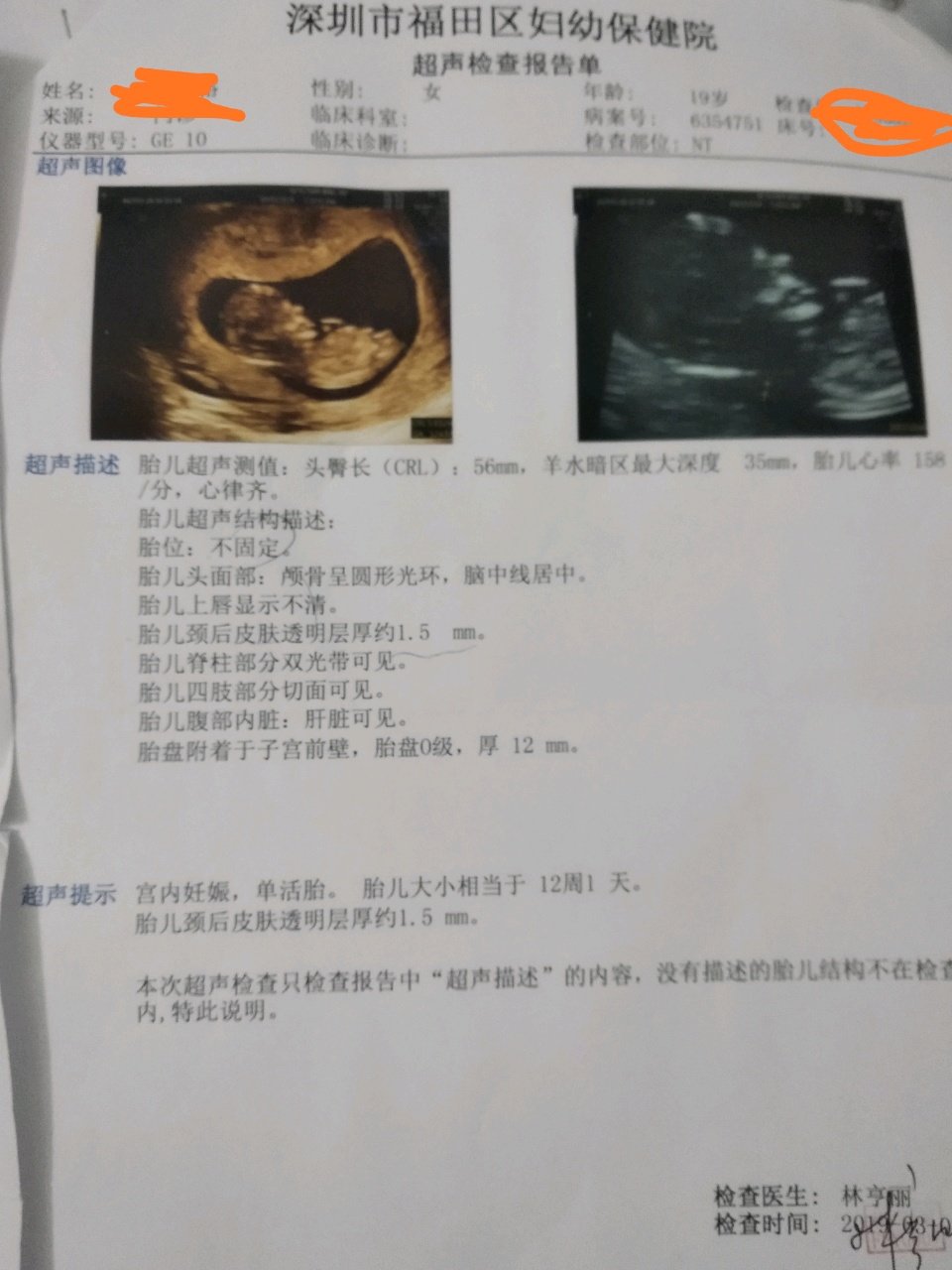 因为我们年龄太小，无能力养