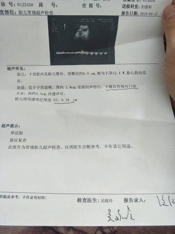 journal_insert_pic_1217045430