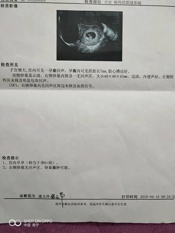 journal_insert_pic_1219151562