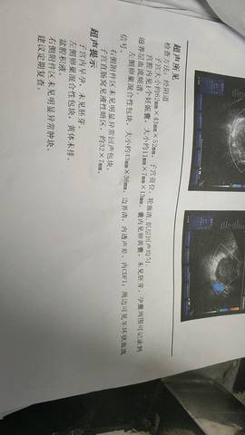 journal_insert_pic_1218910439