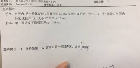 journal_insert_pic_1223154287