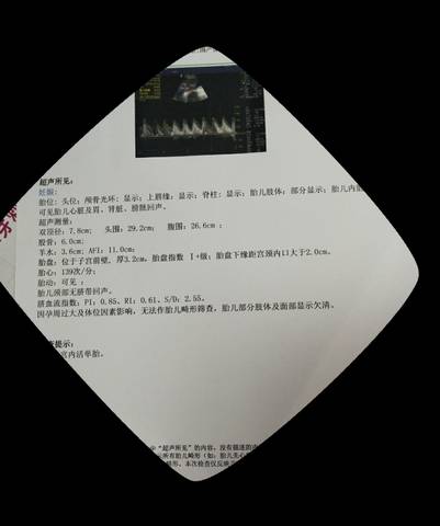 journal_insert_pic_1223240458