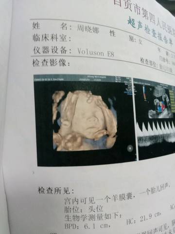 journal_insert_pic_1224491720