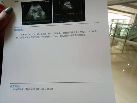 journal_insert_pic_1225763635