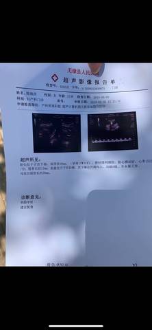 journal_insert_pic_1227500493