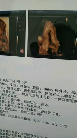 journal_insert_pic_1227432043