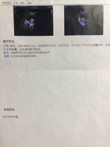 journal_insert_pic_1230730826