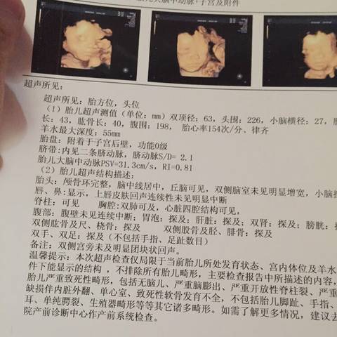 journal_insert_pic_1230451653