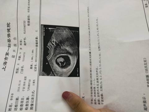 journal_insert_pic_1230318552