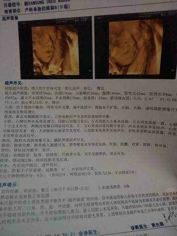 journal_insert_pic_1230855795