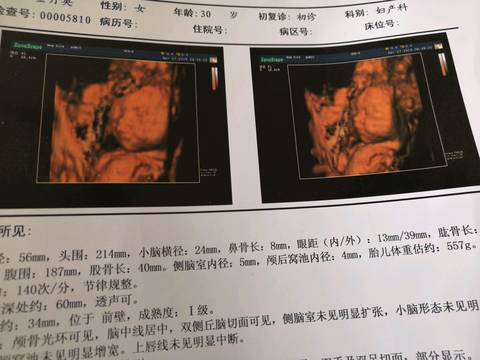 journal_insert_pic_1231119164
