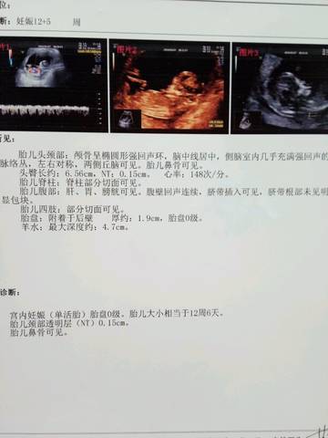 journal_insert_pic_1231276718