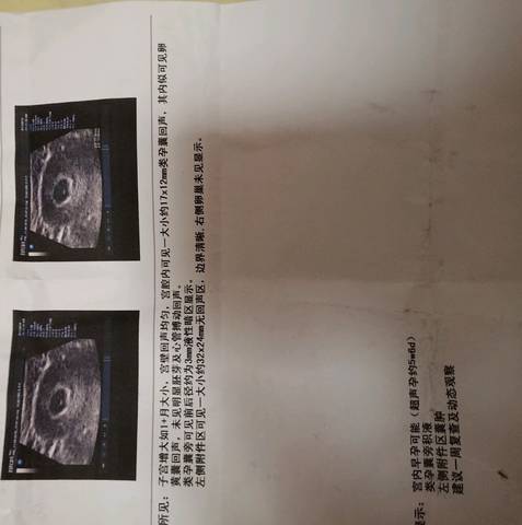 journal_insert_pic_1233824117