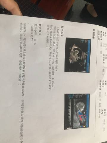 journal_insert_pic_1233620601