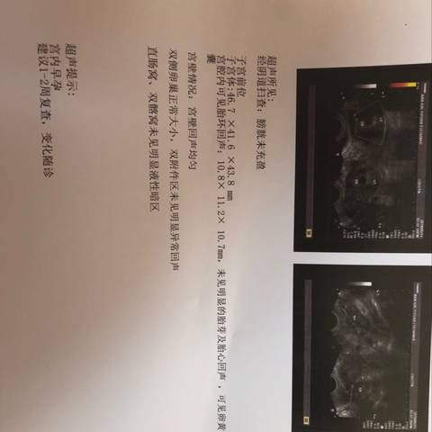journal_insert_pic_1234013172