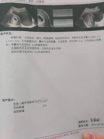 journal_insert_pic_1234447341