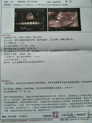 journal_insert_pic_1235555705