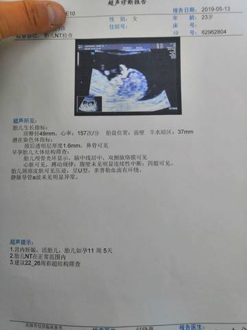 journal_insert_pic_1235454824