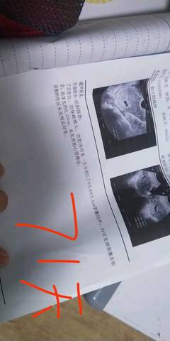 journal_insert_pic_1235713896