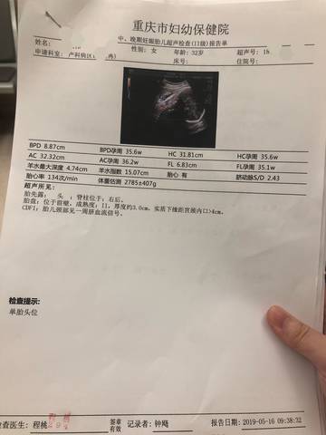 journal_insert_pic_1237054662
